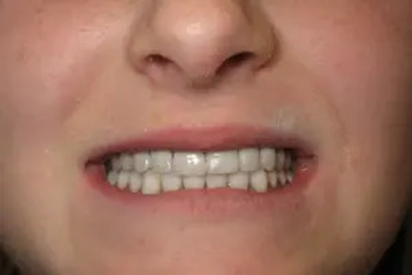image of After 1
