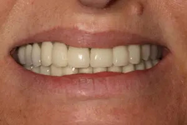 image of After 2