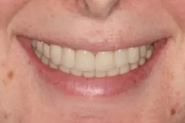image of After 3