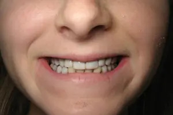 image of Before 1