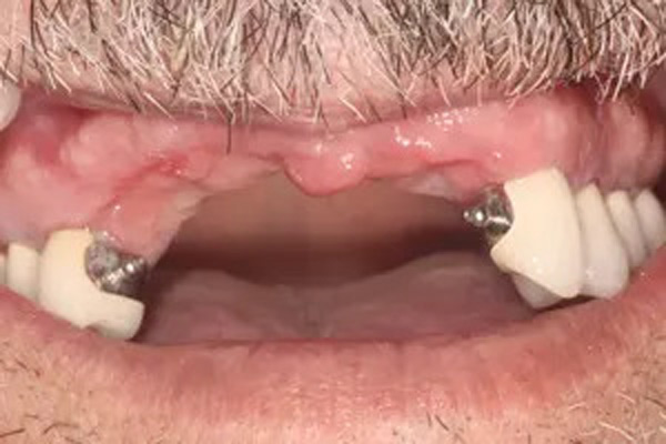 image of Before 4