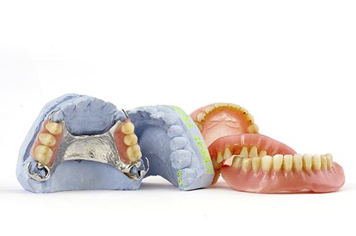 lab molds of full and partial dentures