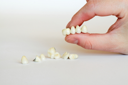 Image of a dental bridge held in hand, at St. Louis Prosthodontics.